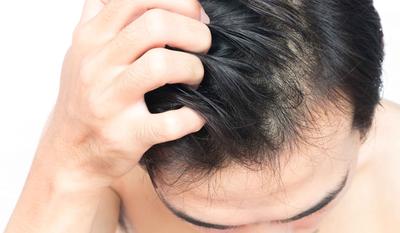快问医生 屁股缝竟然长毛了！这些“肛毛的秘密”