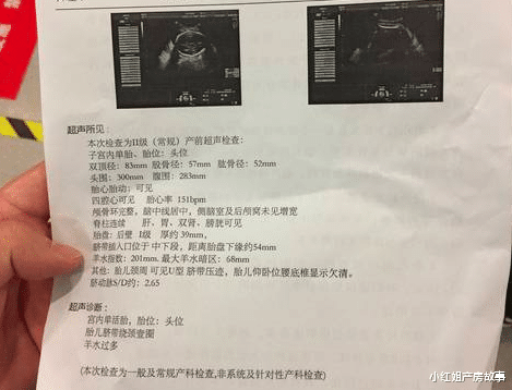 小红姐产房故事|孕期过半，出现羊水过多，为什么有些需要终止妊娠，能事先预防吗？