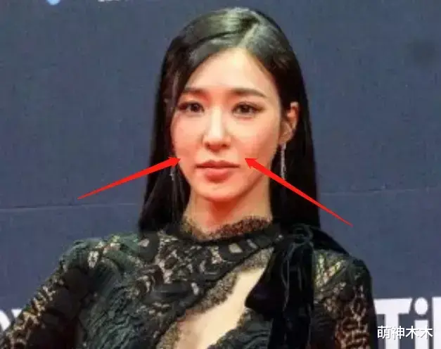 颁奖礼|好多整容脸!外网曝韩国颁奖礼生图,明星动鼻子后遗症太明显