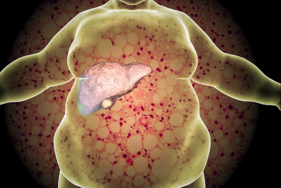 通便|肝脏“除油剂”发现了，医生：常吃3种食物，可给肝刮刮油