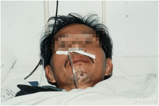 甲状腺癌|夫妻双双查出甲状腺癌，医生提醒：这道菜是“元凶”，很多人爱吃