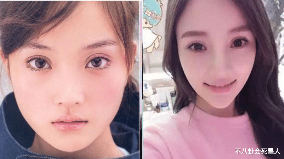 孙菲菲|明星动下巴千奇百怪，李小璐又尖又翘，孙菲菲不愿照镜子