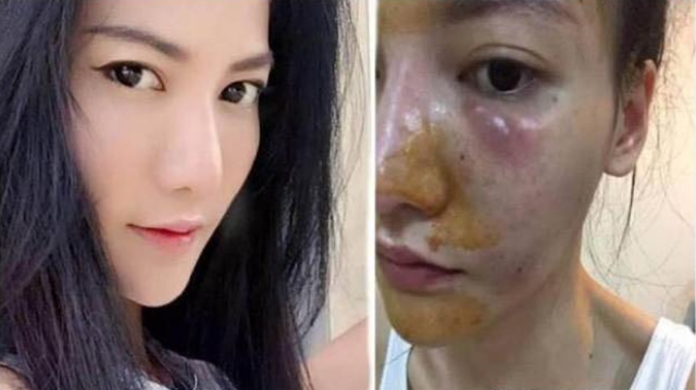 好物官|为什么不建议女生打“美白针”？专家说出实情，网友：幸好没跟风
