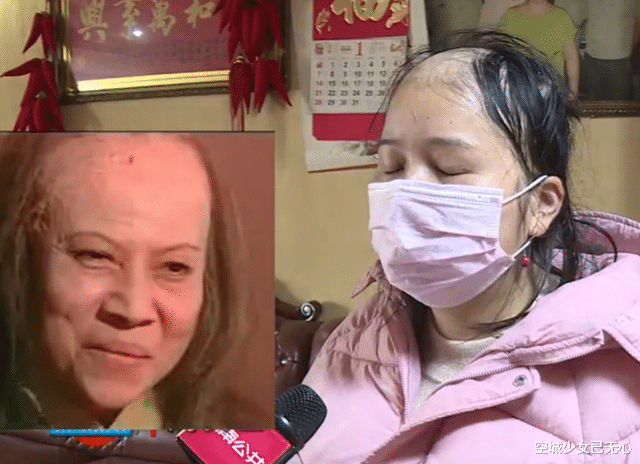 朴信惠 美女去洗完头结果秃成“裘千尺”，美发店：我又没给你用硫酸洗