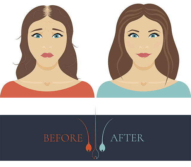 脱发|头发稀少怎么变浓密？