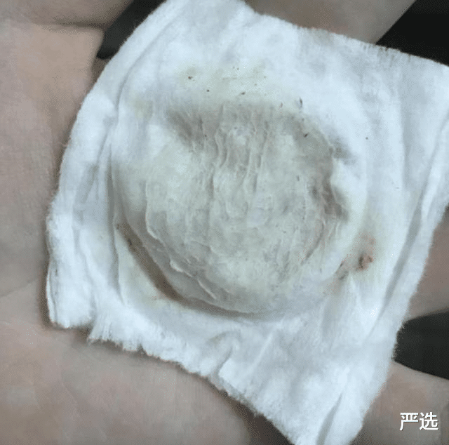 皮衣|沈梦辰“整容式”护肤，难怪现在站C位，“黑鸭子”变“白天鹅”