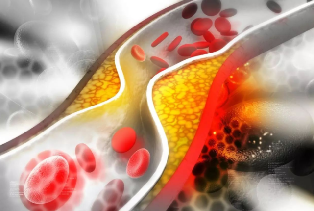 胆固醇|高胆固醇榜单公布:鸡蛋排末尾,榜首胆固醇成倍涨,很多人当补品