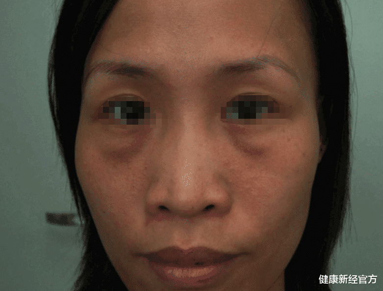 符娜娜星座|54岁阿姨天天养生，查出肝硬化，医生：3种中药堪称“烂肝大户”，勿多吃