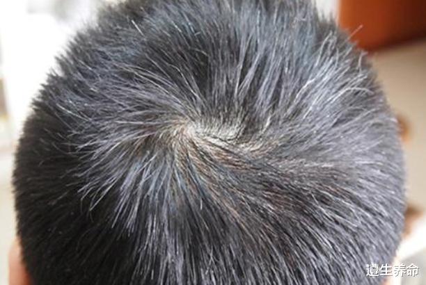 白发|长了白头发不要染，不妨多吃这3种食物，白发或能变少