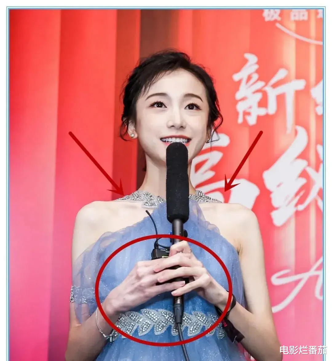 林瑞阳|“内卷”下暴瘦的娱乐圈明星,有的瘦到74斤,有的体力不支坐轮椅