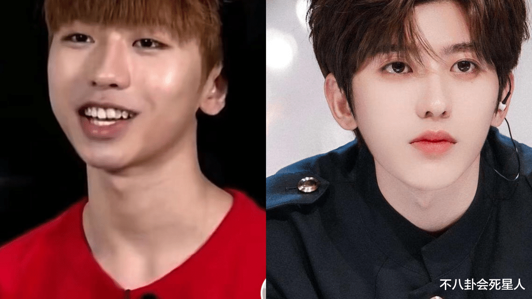 孙菲菲|明星动下巴千奇百怪，李小璐又尖又翘，孙菲菲不愿照镜子