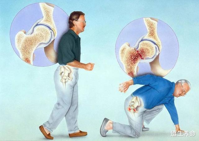 过敏|老年人为啥摔一跤就骨折？50岁后，2种肉请舍得吃，让骨骼更强硬