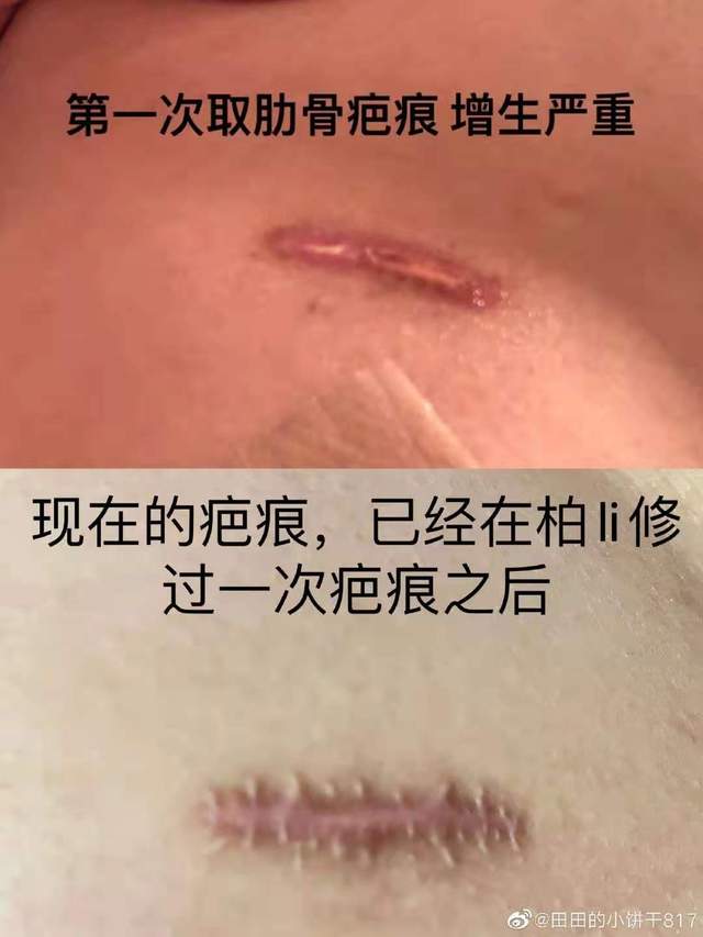 李家人翻译 美容事故纠纷不断却依旧无人管！院方：随便起诉！