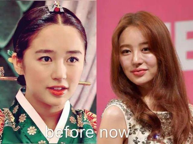 医美|圈内「素颜天花板」颜值大翻车，无数网友血书求她去做医美