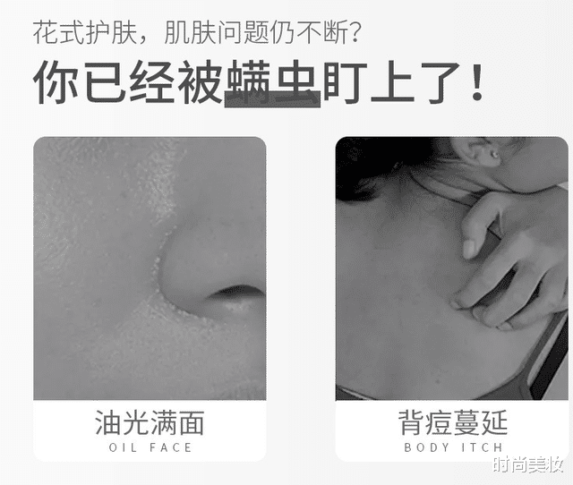 时尚美妆|提醒：“螨虫脸”的人，有这3个明显感觉，说明螨虫“缠上”你了