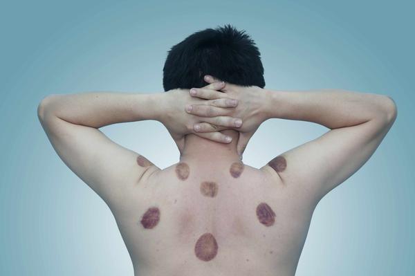 运动|体内寒气重,夏季清除寒气是好时机,这4个方法不妨试试