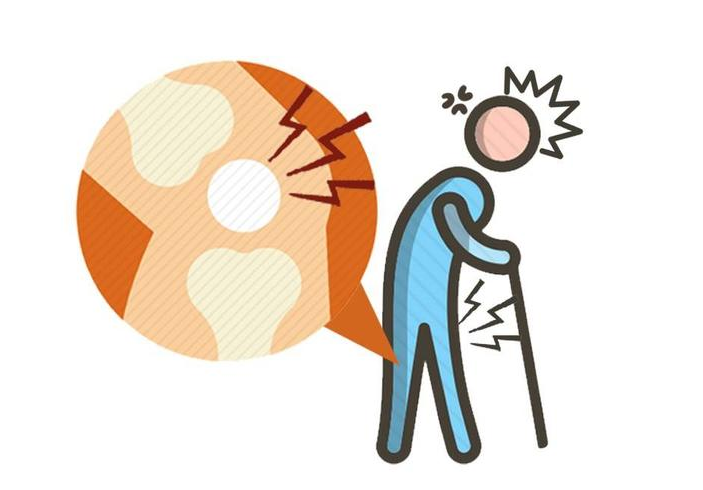 降压药|血压高，长期服用降压药，3个副作用在所难免，做好4点可缓解