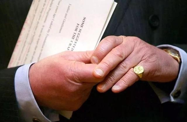 日本|71岁查尔斯访问印度，脱下鞋袜双脚肿得像馒头，为何他手脚都红肿