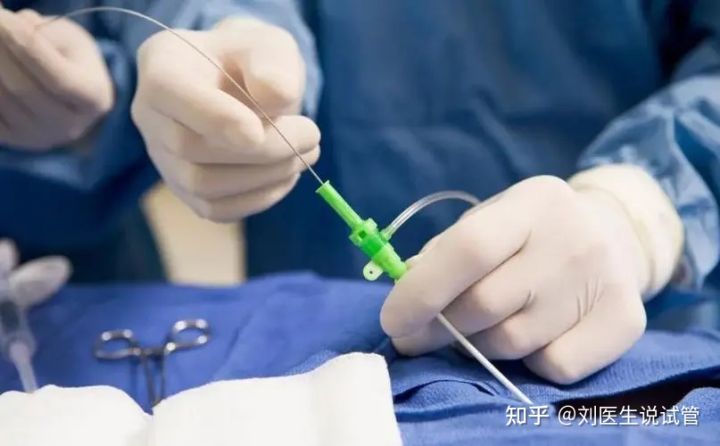 老夏聊备孕|试管婴儿一次能成功吗？做第二次试管需要注意什么？