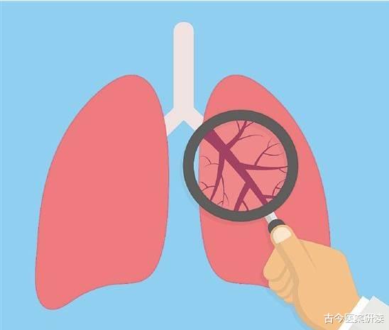 古今医案研读|60岁男子肺癌离家出走,医生叹息:吸烟10年以上有4种症状,是肺在求救
