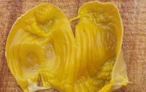 百艾堂|腰腹赘肉：藏着代谢不掉的痰湿！4个方法去除，你也可以！