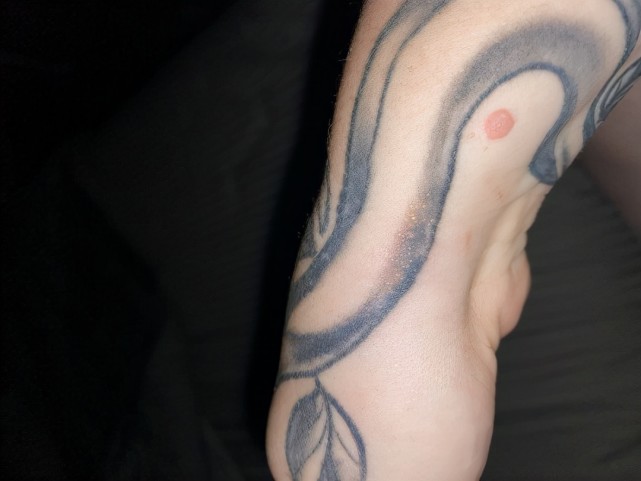 免疫系统|文身对身体有害吗？美国宝妈花150美元文身，结果疣顺着纹路疯长