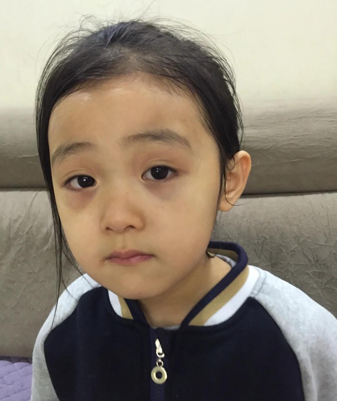 美容|皮肤白也不好？脸上的几个缺点很明显，你有吗