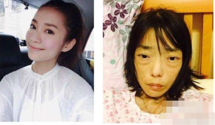 |伍智恒：22岁成百亿阔太，丈夫一句“你胖了”，从此瘦成外星人