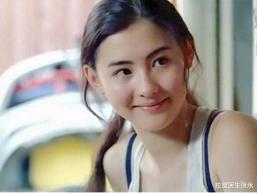 张柏芝|面部折叠度高的明星有哪些？