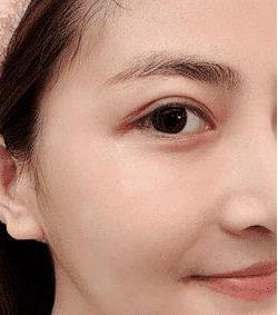 好物官|被抖音带火的“祛痘神器”, 毛孔痘印全消失，半个娱乐圈人手一支