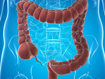 玄玄|北京东大肛肠医院科普:引起肛门息肉的因素有哪些?