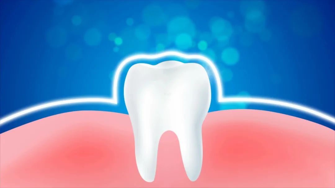 牙痛|金元名医李东垣：这个方剂只有5味药，却是调理胃火牙痛的常用方