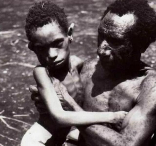  食人部落与“笑死病”：为何哺乳动物不能同类相食？