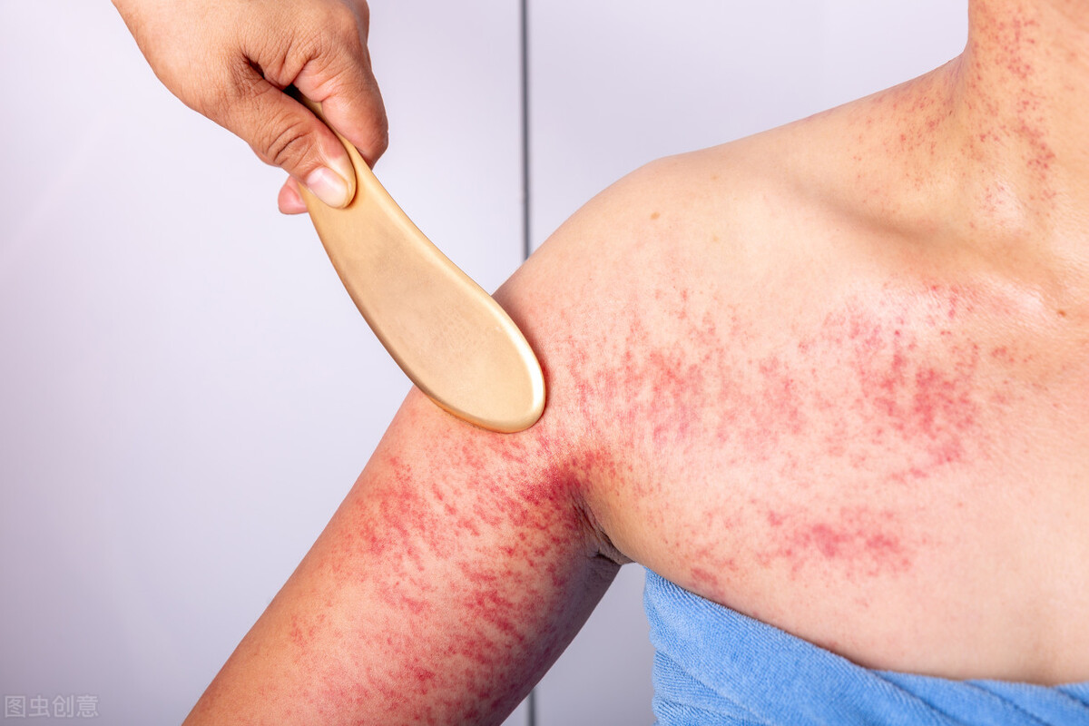 胃病|奖门人：咽喉异物感强，吐不出来也咽不下去？赶快拍打肘窝，有奇效！