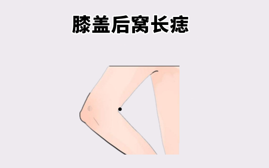 中国易经风水|“百里难挑的5颗痣”，颗颗带财，男人仕途顺，女人家业旺！