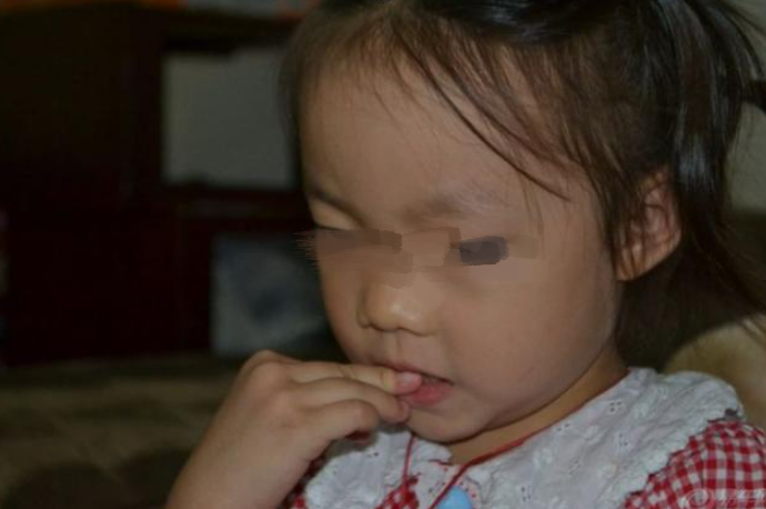 糖果的妈妈|“撕嘴皮”的孩子不怕痛吗？小动作中藏着许多原因，家长了解几个