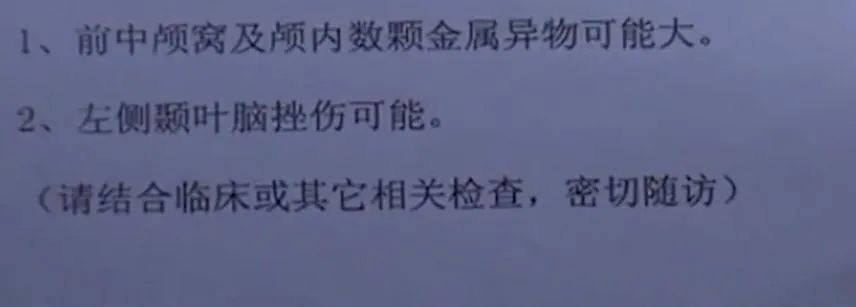 蹦极 那个全脸都是弹片的女孩