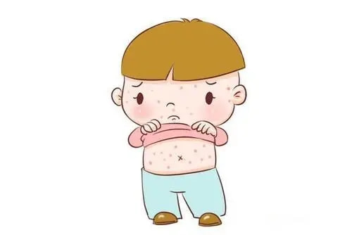 小儿推拿杨晓|中医儿科杨晓:什么是儿童过敏性体质?有哪些症状?如何调理?