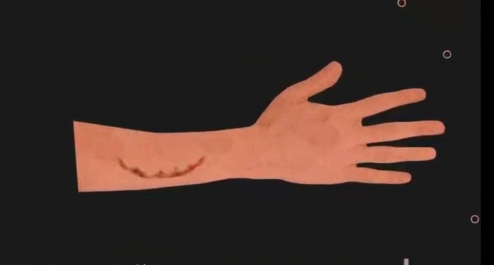 狂犬病|伴随人类几千年的狂犬病,到底有多可怕?