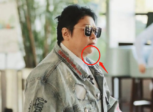 韩红|韩红暴瘦后罕见露面！减肥40斤瘦出尖下巴，穿六千元外套打扮潮流