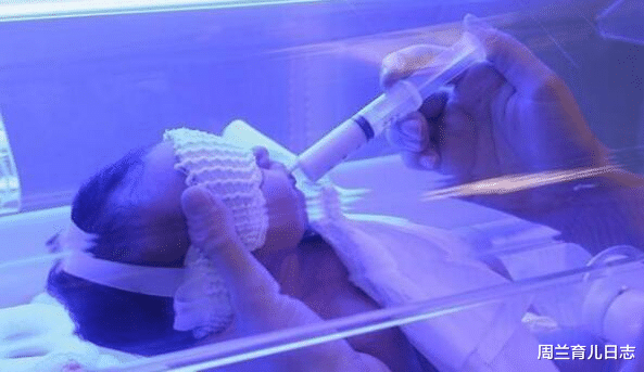 周兰育儿日志|宝宝出生后，成了“小黄人”，可能与孕期这几个坏习惯有关