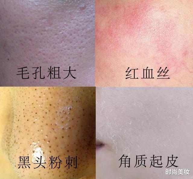 luna|吴昕皮肤光滑白皙，坚持每天用它洗脸，3次就能“震”毛孔垃圾