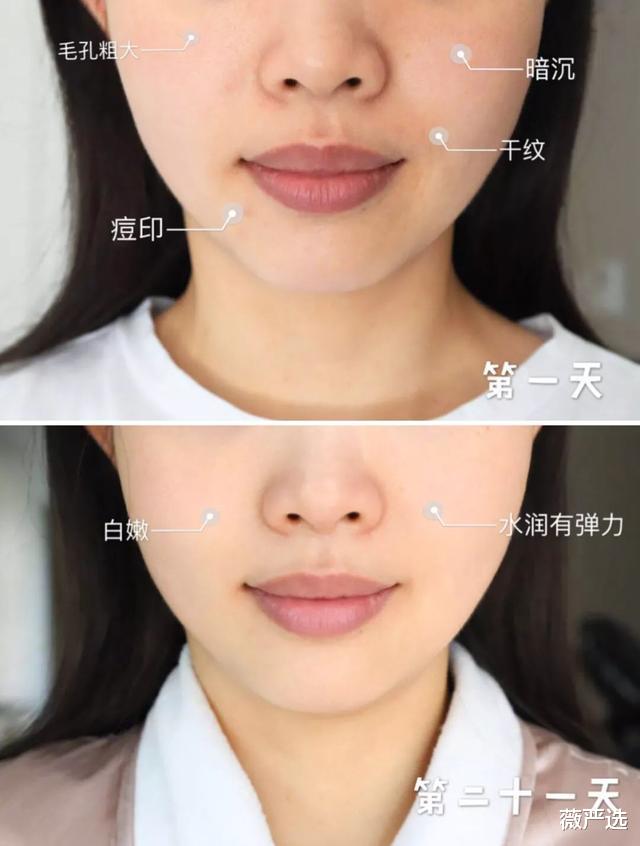 石原里美 变美活教材！石原里美分享十年变美之路，上演现实版丑小鸭变天鹅