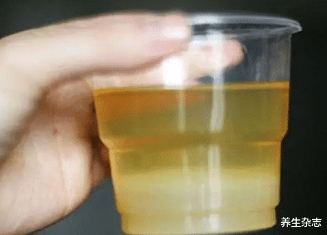 肝脏|体内有癌,肩膀先知!肩部若有这1种症状,可能是肝癌先兆