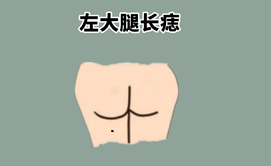 中国易经风水|身上5颗“黄金”痣,天生皇帝命,一个聚财,一个生金,越过越有!