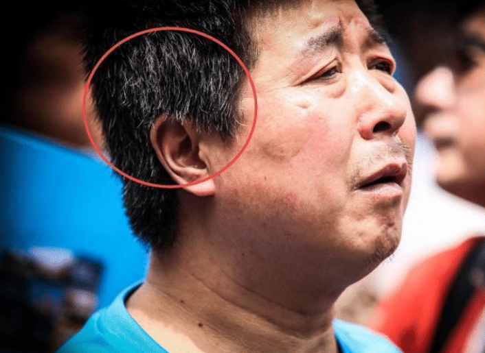 肝脏|?男性晨起3处“发臭”，肝或已“烂如渔网”，一个不占，肝还“强壮”