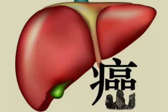 小思医生|体内有癌，头部先知？头部若有4个“异常”，或是肝癌“到访”