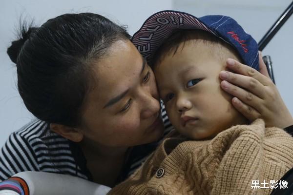 黑土影像 安徽一2岁男童眼睛突然发光疑似猫眼,医生看了后说眼球保不住了