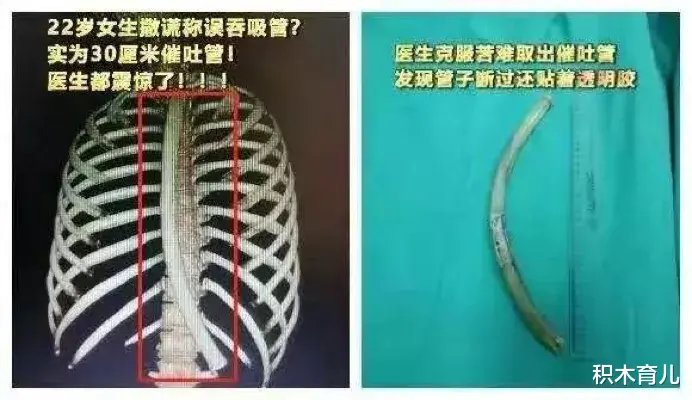 女孩 照片泄露事件13年后,阿娇最新近照又在网上疯传了