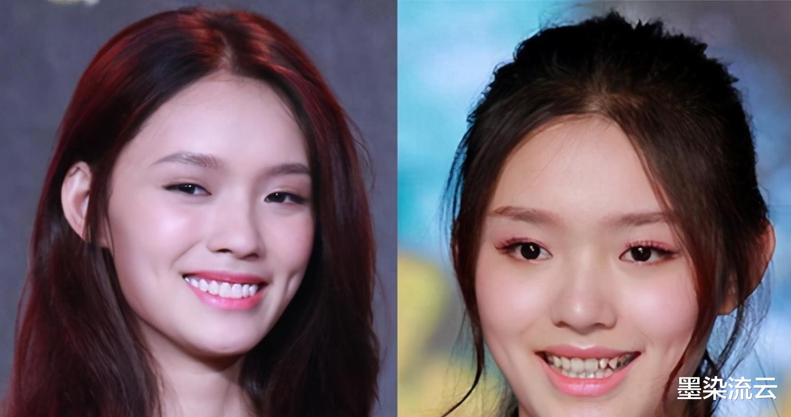 许敏|跟刘涛拍吻戏要注意,满嘴烤瓷牙可是花了300万,不小心就要赔惨了